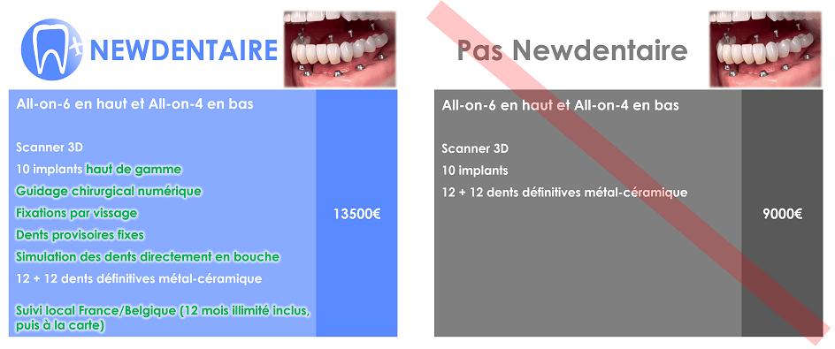 Ce qu'il ne faut pas faire pour refaire ses dents