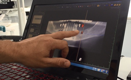 Contrôle qualité tourisme dentaire dentisterie digitale