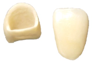 Couronne dentaire en Zircone