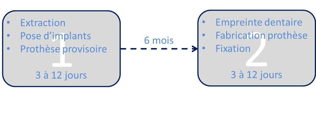 Durée de pose implant dentaire