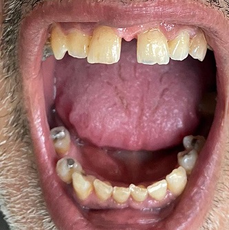 Photo dentition 2