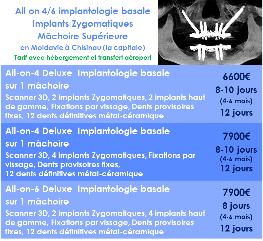 Prix All-on-4 implant basal Zygomatique