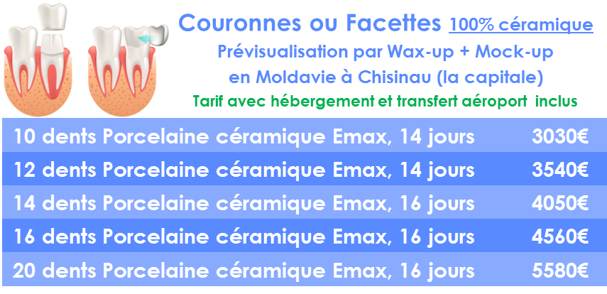 Prix couronne dentaire céramique en moldavie