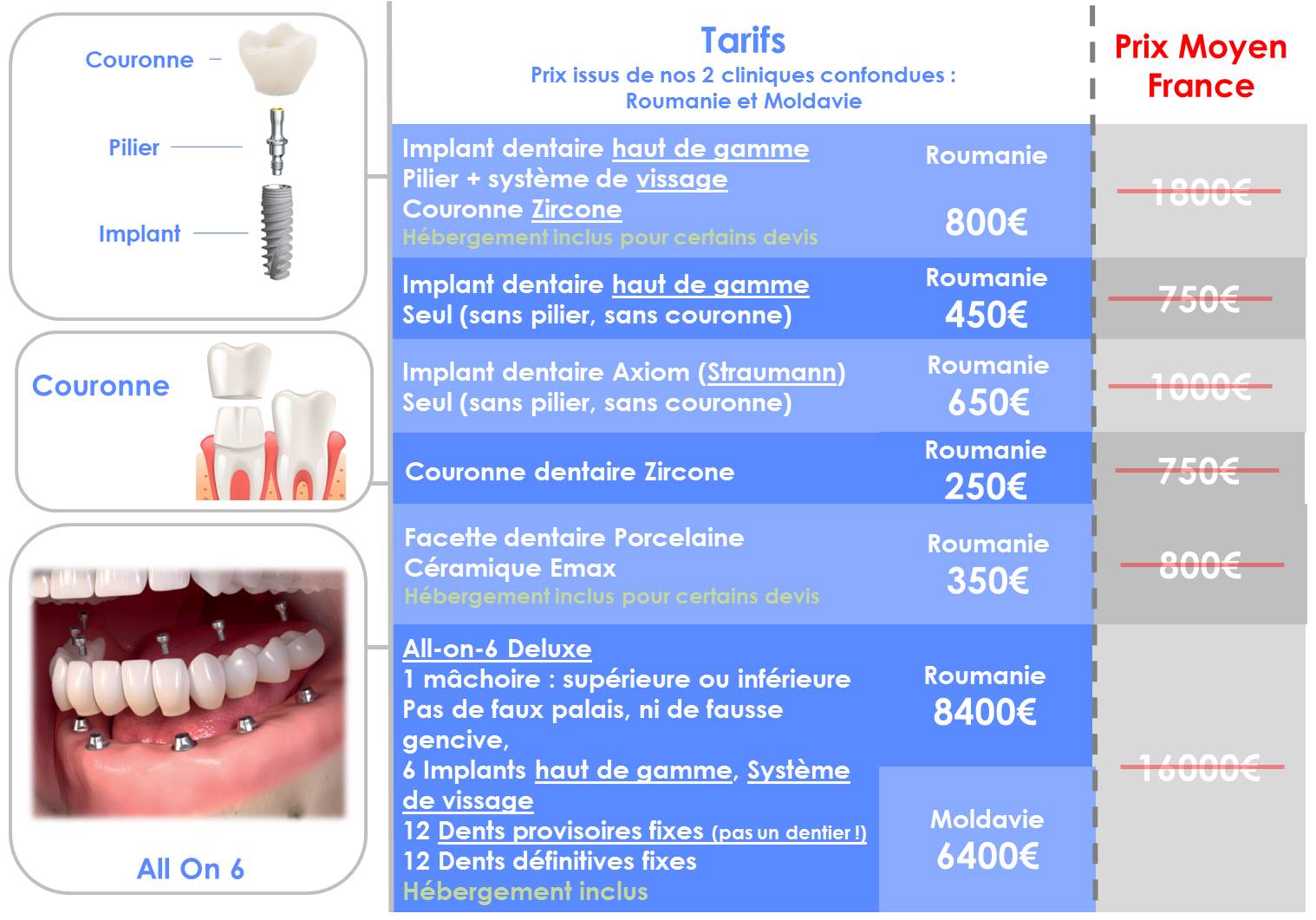 Prix implant dentaire Roumanie