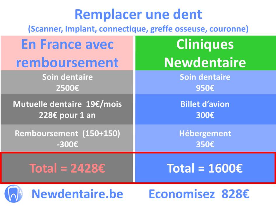Remboursement implant dentaire France pour 1 dent