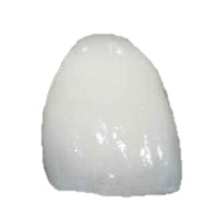 couronne dentaire céramique Emax