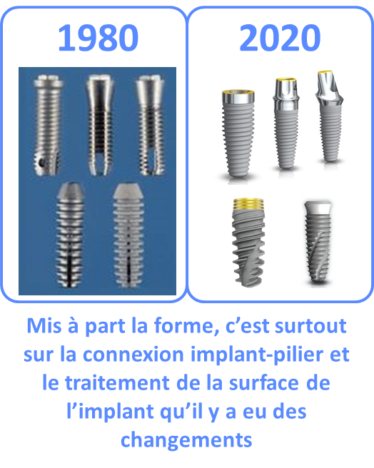évolution implant 1980 2020