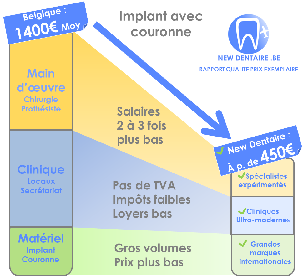 implant dentaire explication prix bas sans réduire la qualité