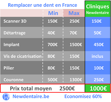 prix implant dentaire pour refaire une dent