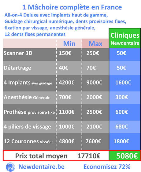 prix implant dentaire pour une mâchoire complète All-on-4