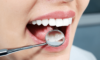 comment refaire ses dents
