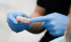 restauration dentaire complète : dentier fixe