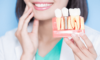 Implant dentaire ou dent sur pivot