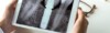 Dent sur pivot - Implant dentaire