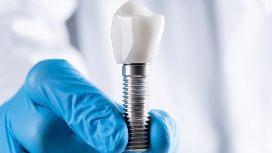 Particularité de l'implant dentaire ptérygoïdien