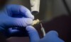 Le bridge dentaire comme solution pour remplacer les dents