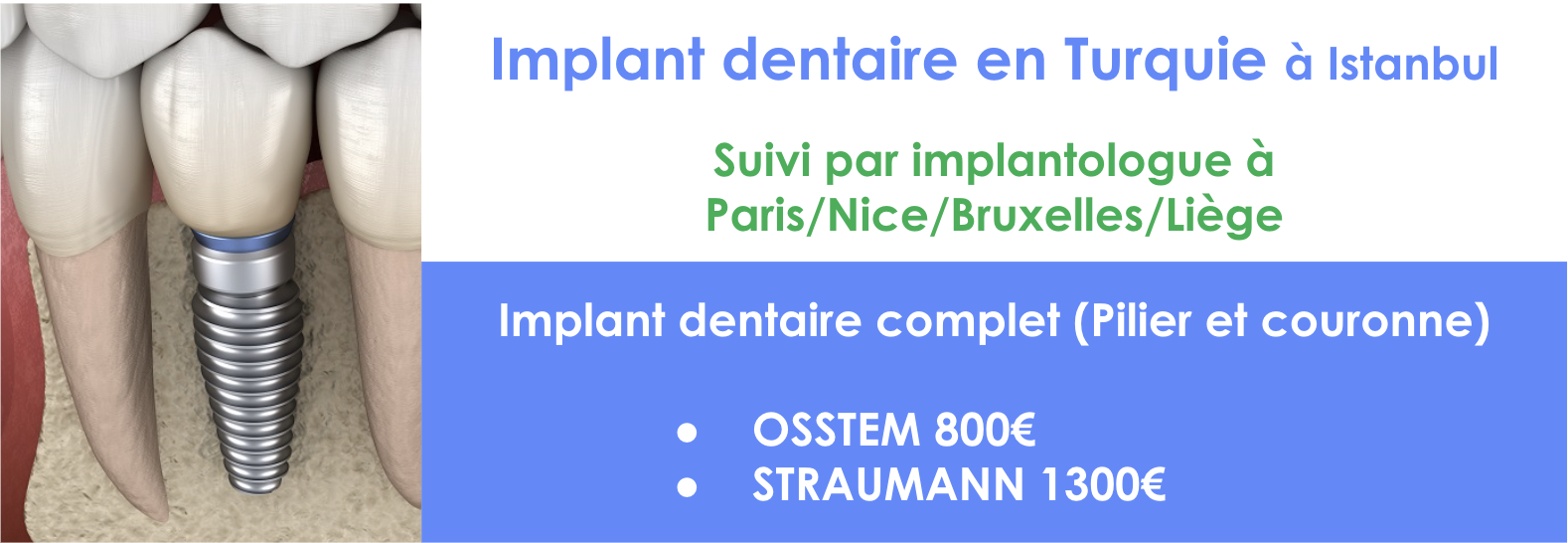 implant-dentaire-turquie-istanbul