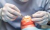 Dentiste prothésiste au travail sur une restauration dentaire.