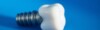 Implant dentaire sur fond bleu.