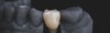 Clinique dentaire réalisant implant dentaire à liège